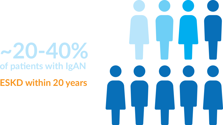 Infographic: 20-40% of patients with IgAN go on to develop end stage kidney disease within 20 years